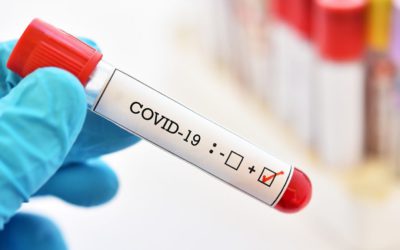 34 raste me COVID-19, të shëruar 12, asnjë i vdekur