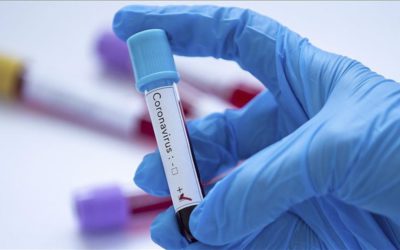 Pesë raste me COVID-19, të shëruar pesë, asnjë i vdekur